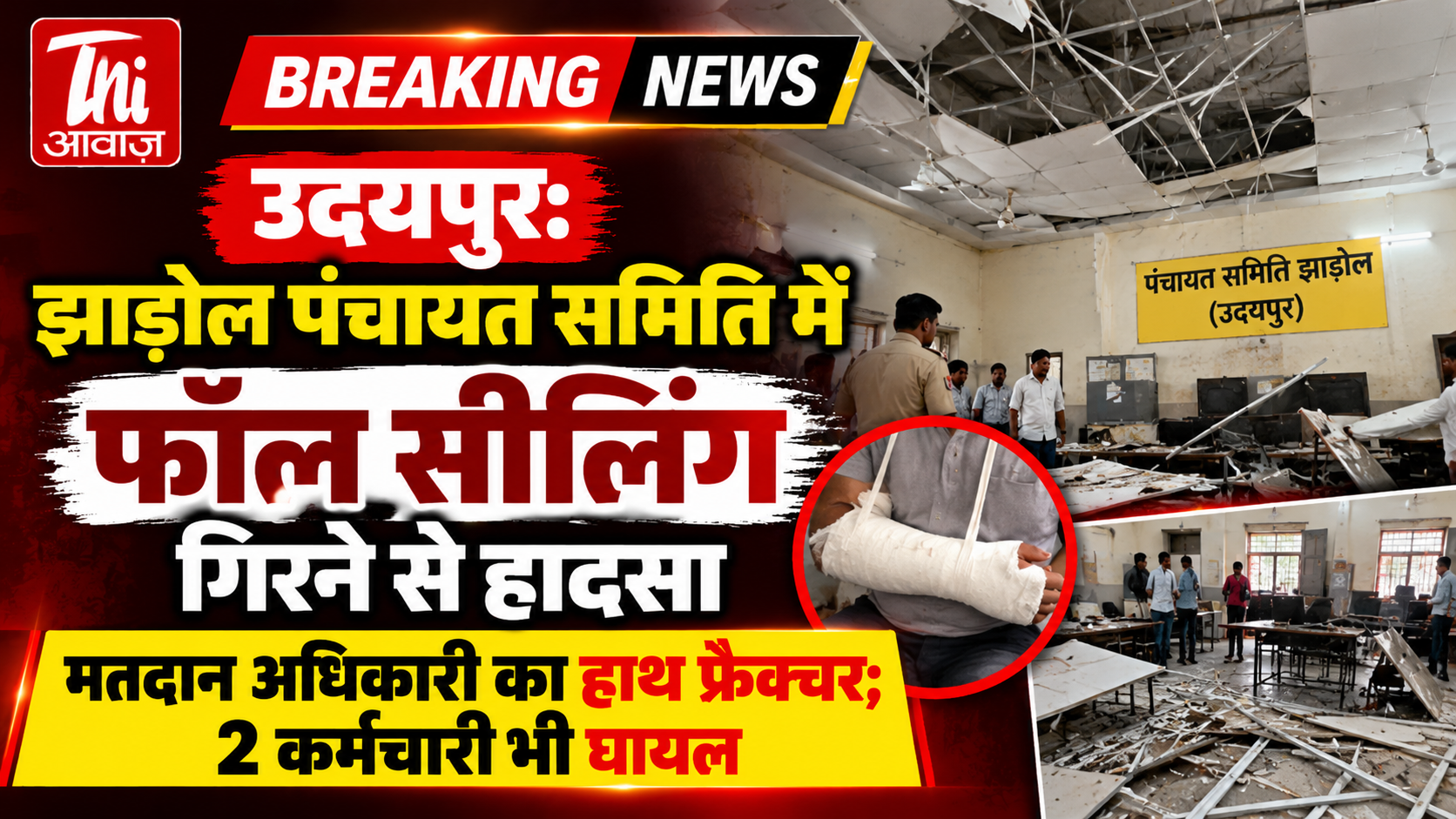 उदयपुर: झाड़ोल पंचायत समिति में फॉल सीलिंग गिरने से हादसा, मतदान अधिकारी का हाथ फ्रैक्चर; 2 कर्मचारी भी घायल
