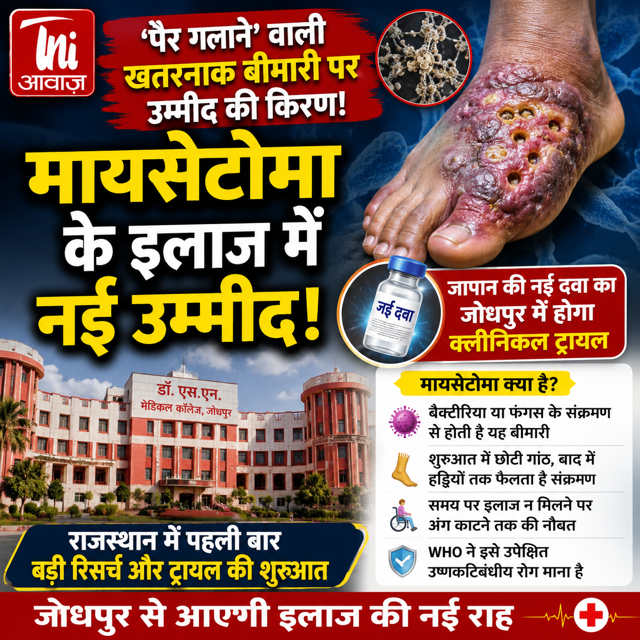 राजस्थान में पहली बार मायसेटोमा पर बड़ी रिसर्च, जापान की नई दवा का जोधपुर में होगा क्लीनिकल ट्रायल 