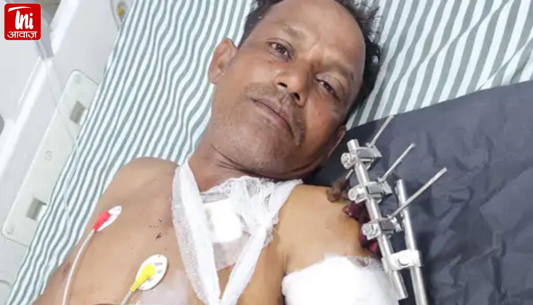 जयपुर में चोरी के प्रयास के दौरान बदमाश ने की फायरिंग, पीछा कर रहे व्यक्ति को बाजू में लगी गोली; पुलिस जांच में जुटी