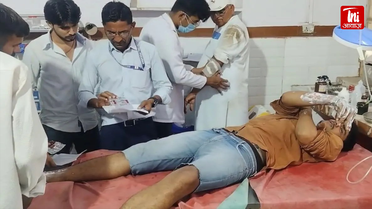 पोकरण में होटल में गैस सिलेंडर लीक से आग, 2 लोग झुलसे