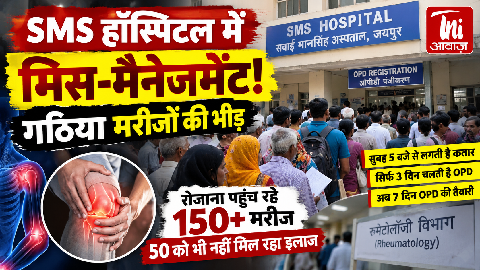 SMS अस्पताल की रूमेटोलॉजी OPD में मिस-मैनेजमेंट! 150 से ज्यादा मरीज रोज पहुंच रहे, 50 को भी नहीं मिल रहा इलाज