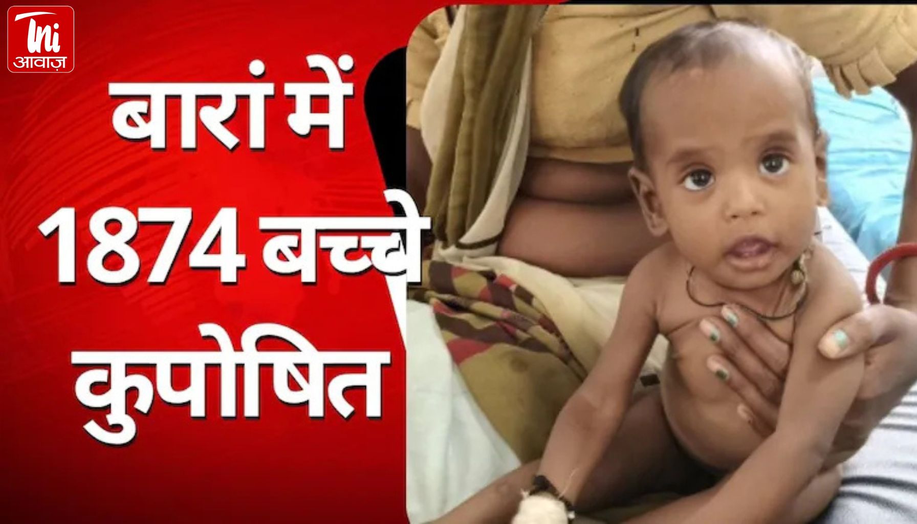 राजस्थान के बारां जिले में 'कुपोषण' की वापसी, केंद्रीय मंत्रालय ने जारी किए हैरान करने वाले आंकड़े